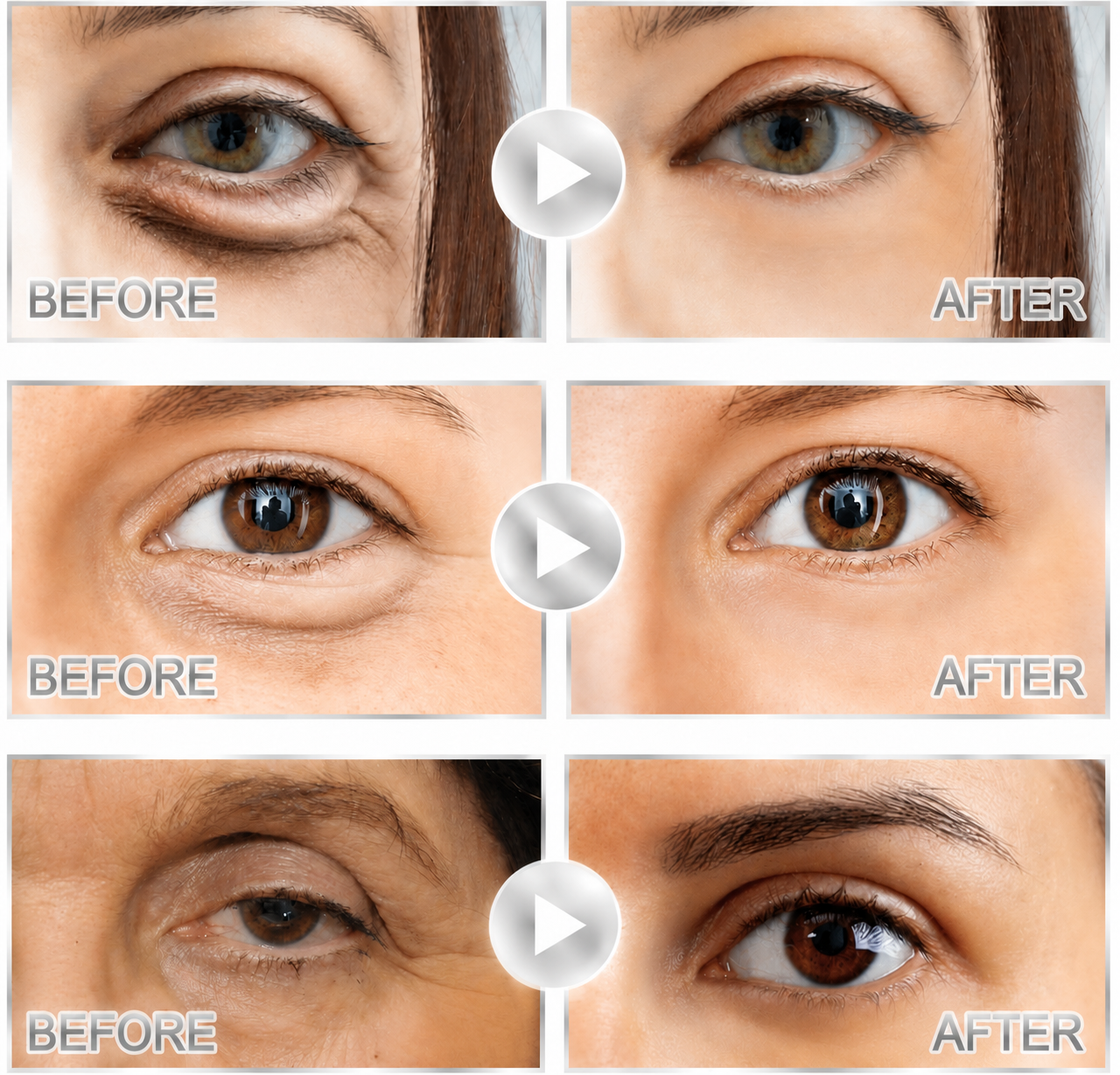 Tryvonna | Dissolving Microneedle Eye Patches