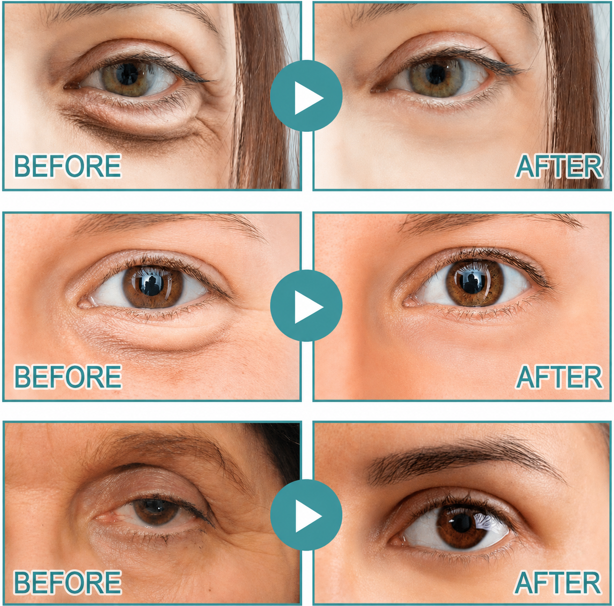 Tryvonna | Dissolving Microneedle Eye Patches