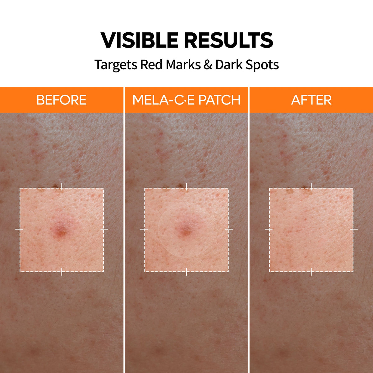 Skavix  Blemish & Dark Spot Patch Duo