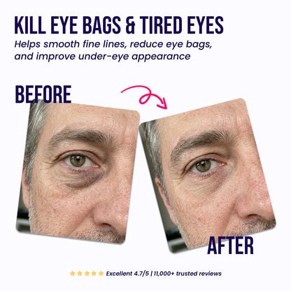 🔥 LAST DAY - BUY 2 GET 1 FREE Under-Eye Repair Patches
